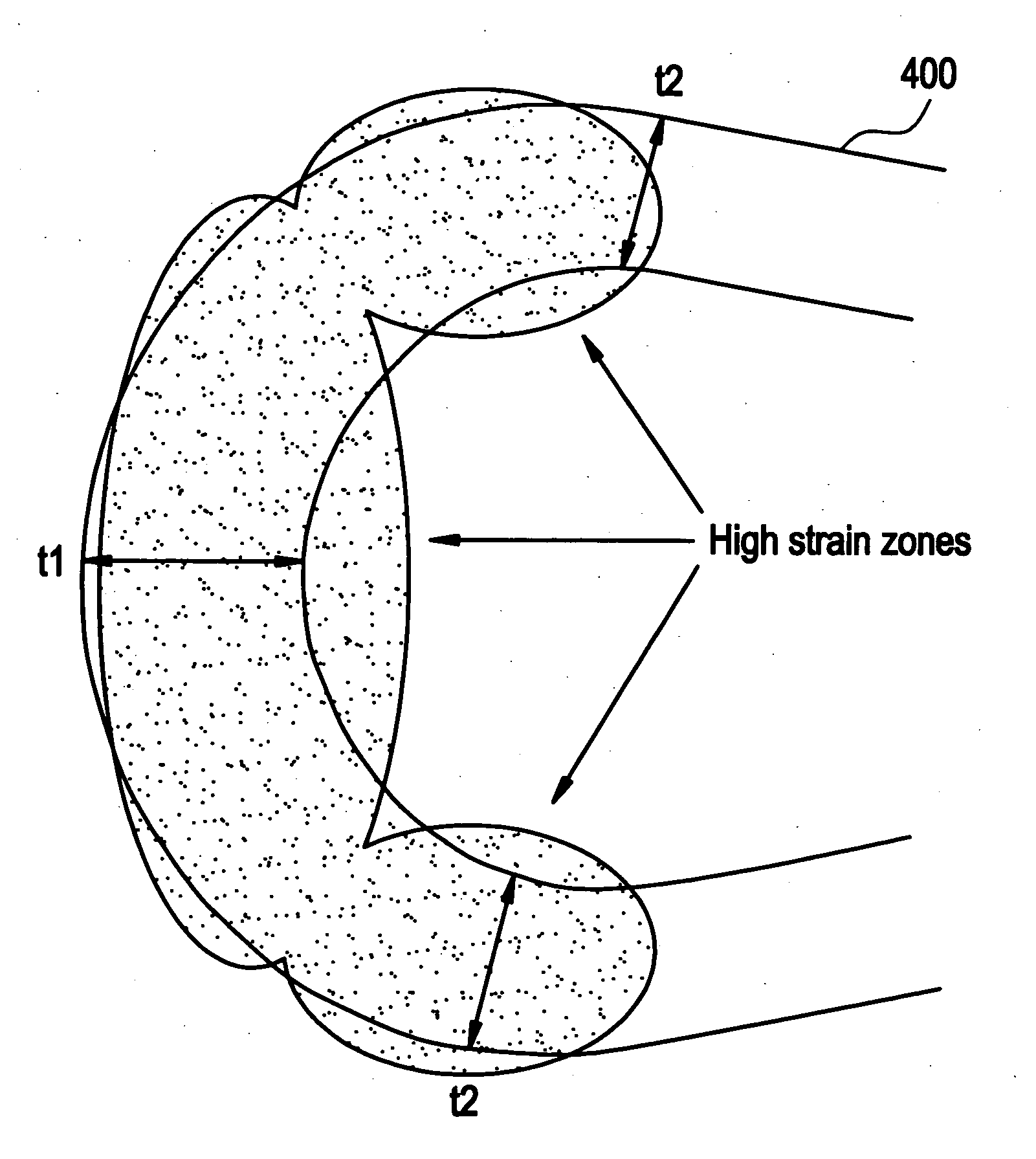 Polymeric stent having modified molecular structures in selected regions of the hoops and method for making the same
