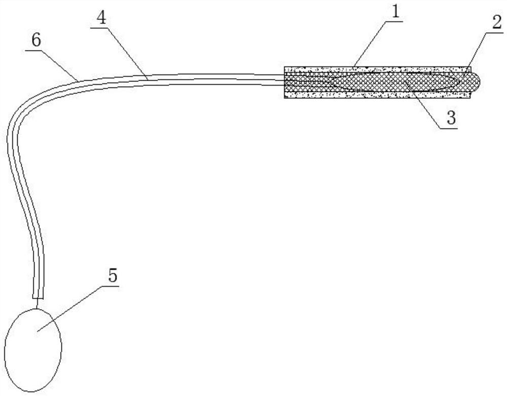 Posterior nasal cavity hemostasis device