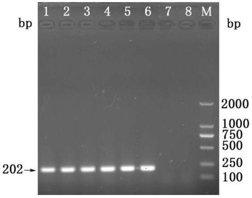 A HRM detection method and primers for rapid identification of mouse encephalomyelitis virus and rat Theileria virus