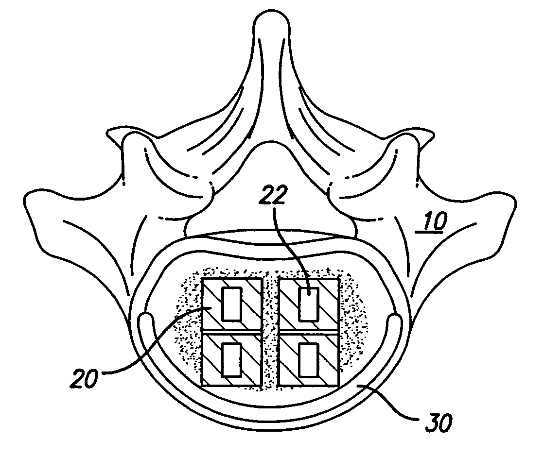 Support device for vertebral fusion