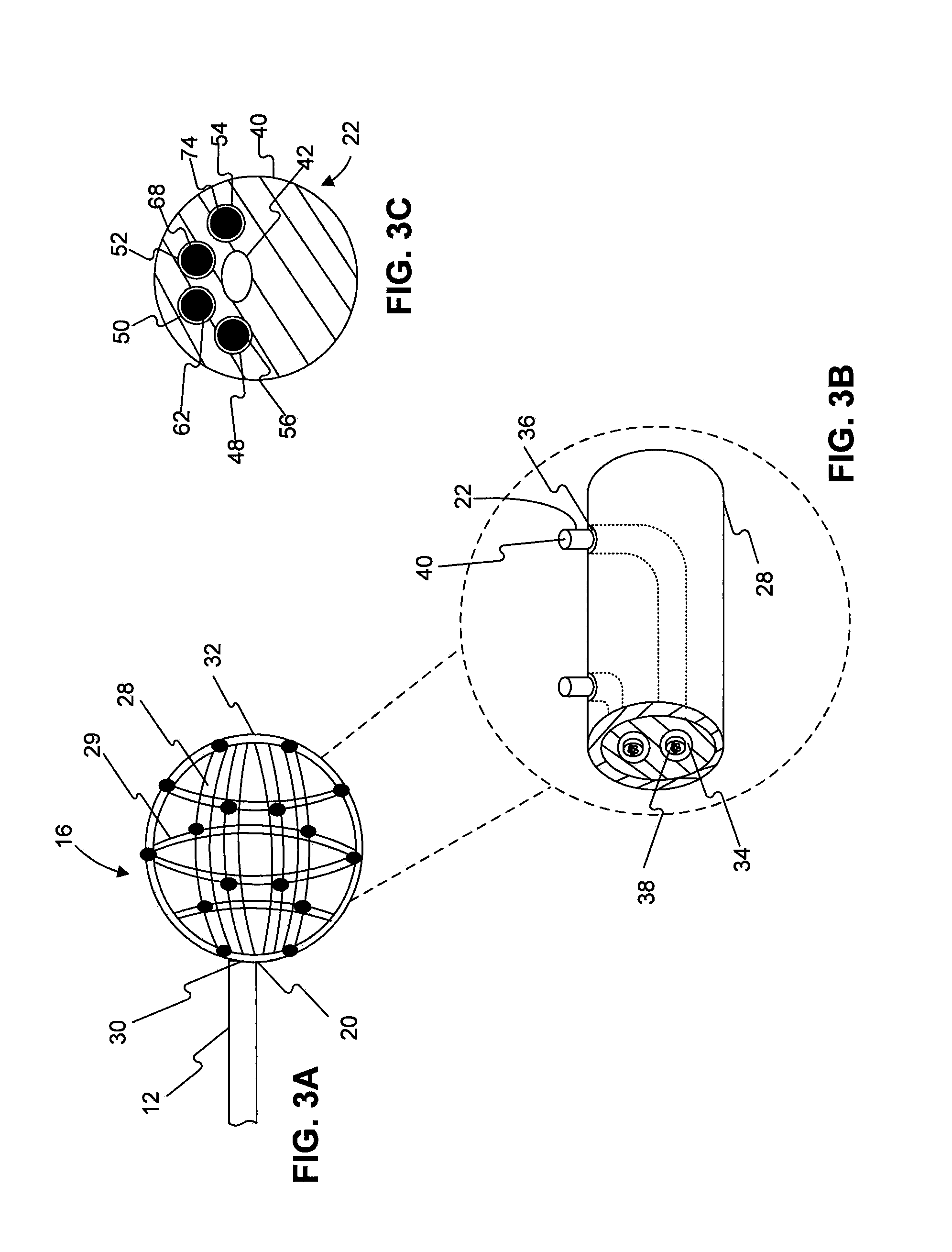 Methods and systems for detection and thermal treatment of lower urinary tract conditions