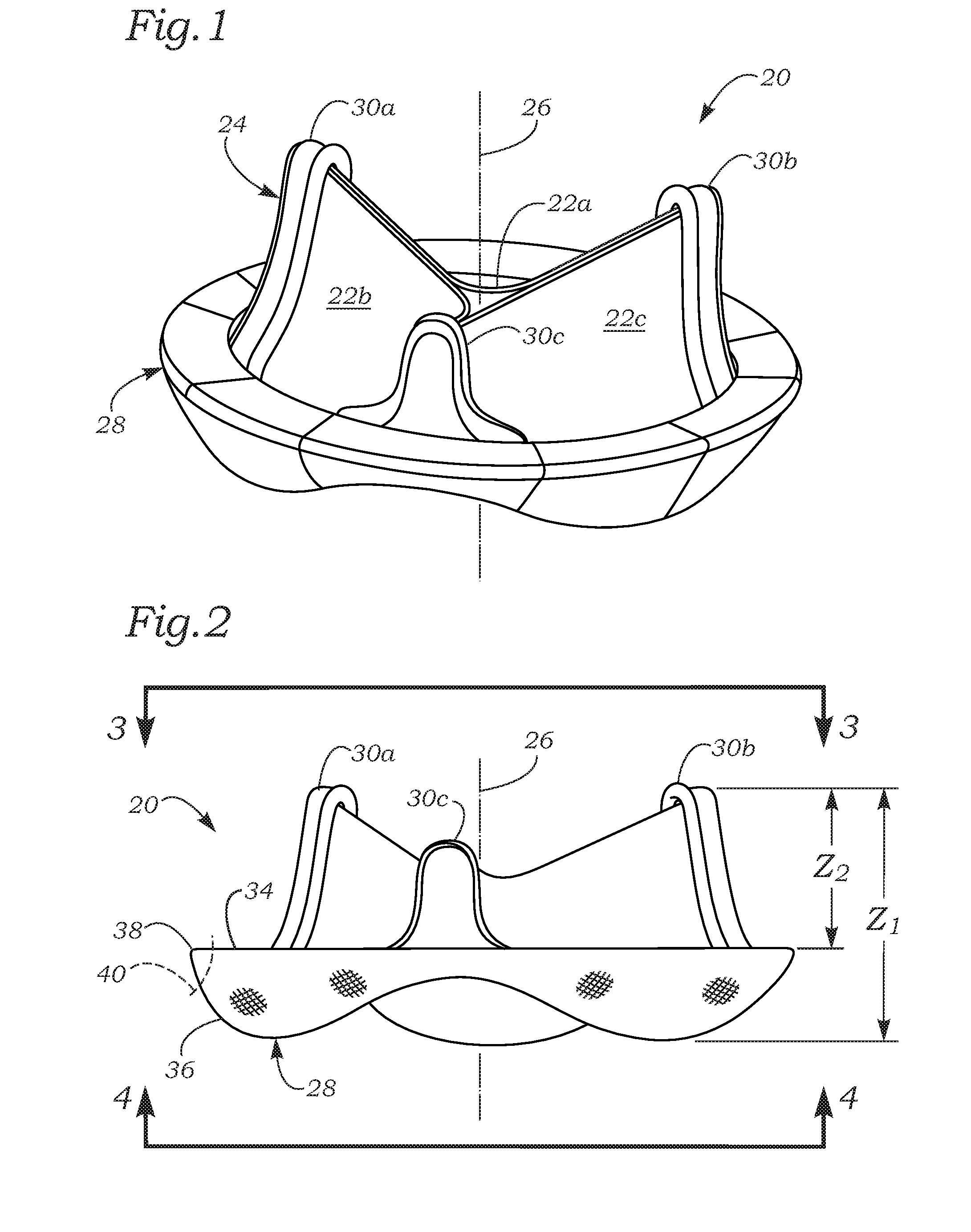 Anatomically Approximate Prosthetic Mitral Valve