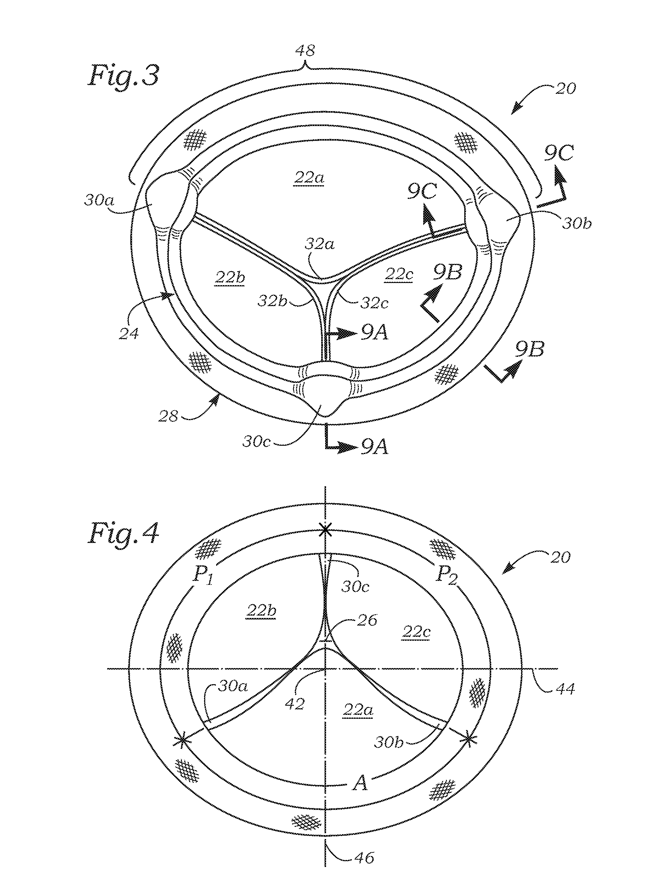 Anatomically Approximate Prosthetic Mitral Valve