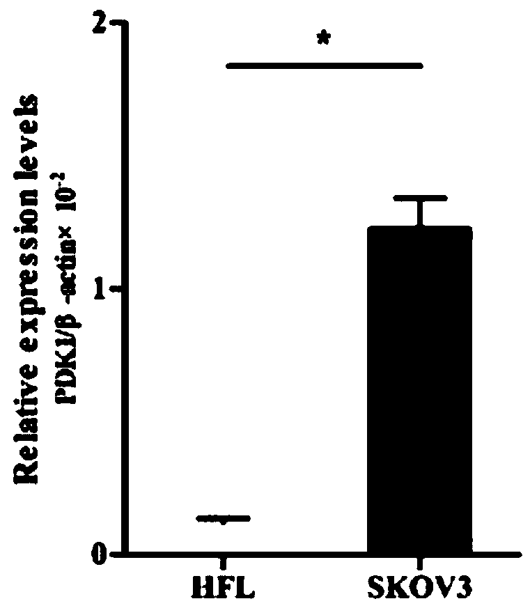 Ovarian cancer diagnosis or prognosis composition and application thereof