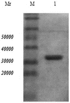 Trichina 7TR protein human single-chain antibody and preparation method and medical application