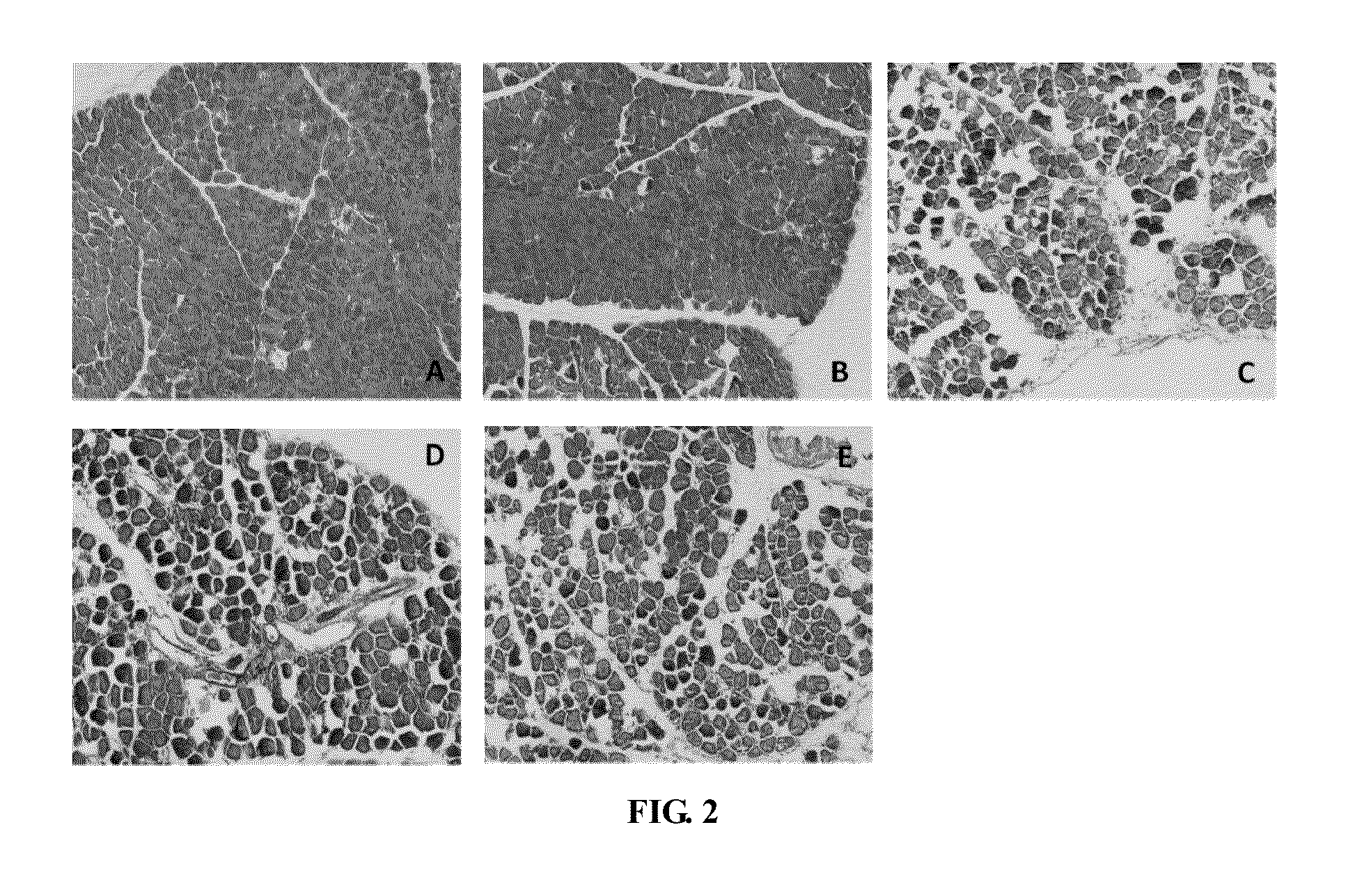 Method of using rhein for treating fibrotic conditions and tumors