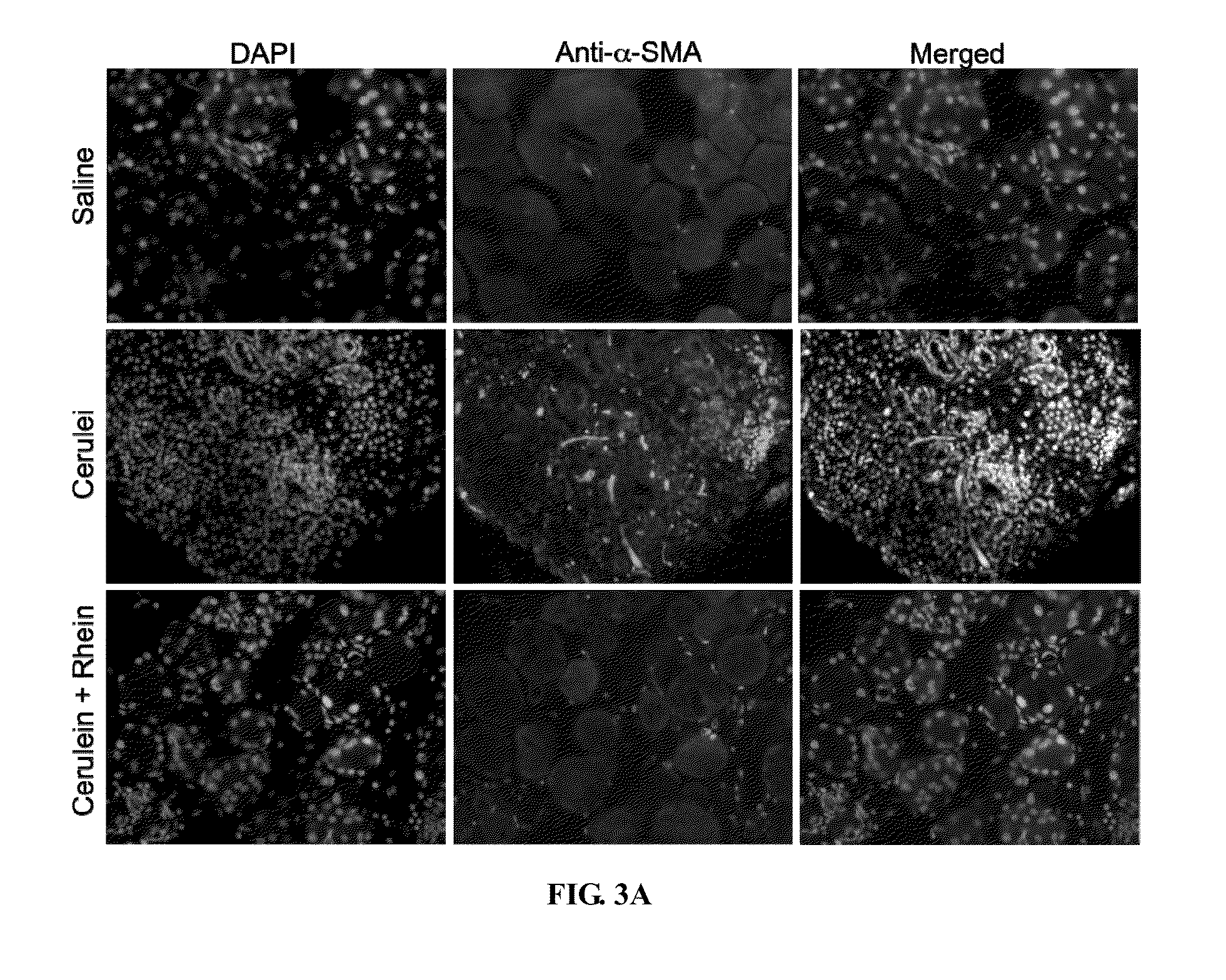 Method of using rhein for treating fibrotic conditions and tumors