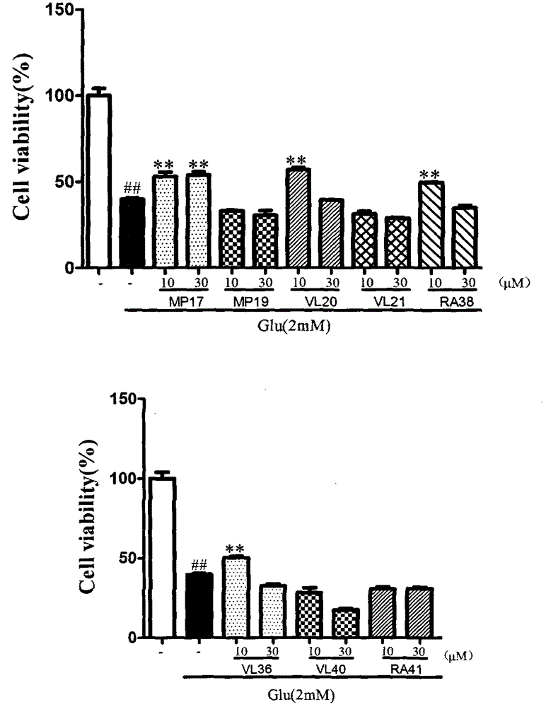 Dimer of rivastigmine and caffeic acid or ferulic acid, preparation method and drug composition thereof