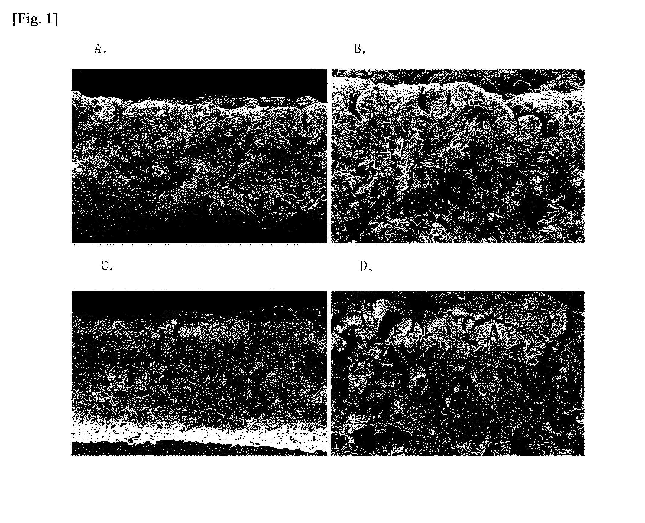 Production Method For Cryopreserved Acellular Dermal Matrix, And Cryopreserved Acellular Dermal Matrix Produced Thereby