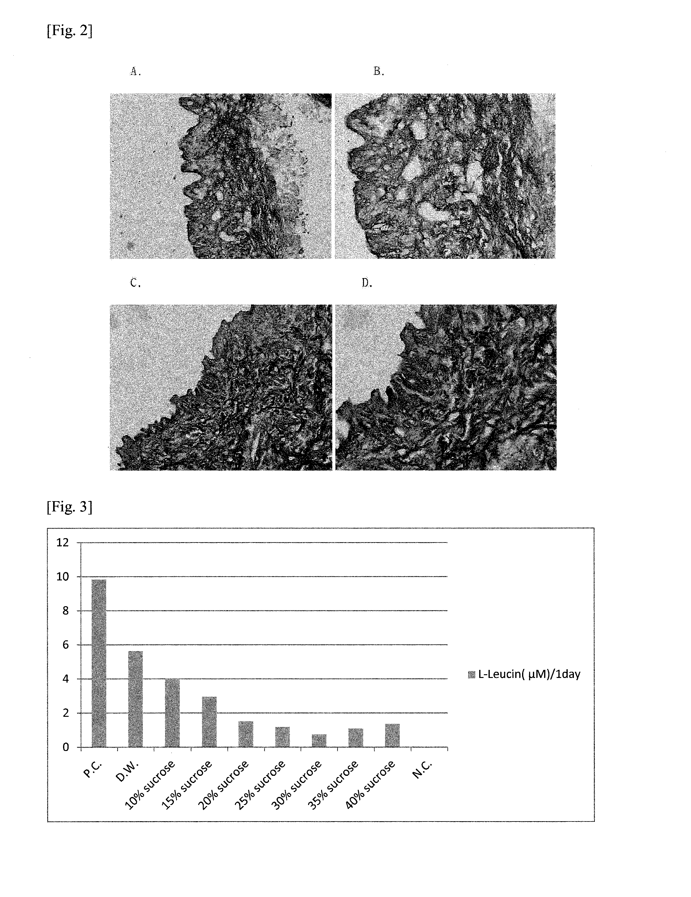Production Method For Cryopreserved Acellular Dermal Matrix, And Cryopreserved Acellular Dermal Matrix Produced Thereby