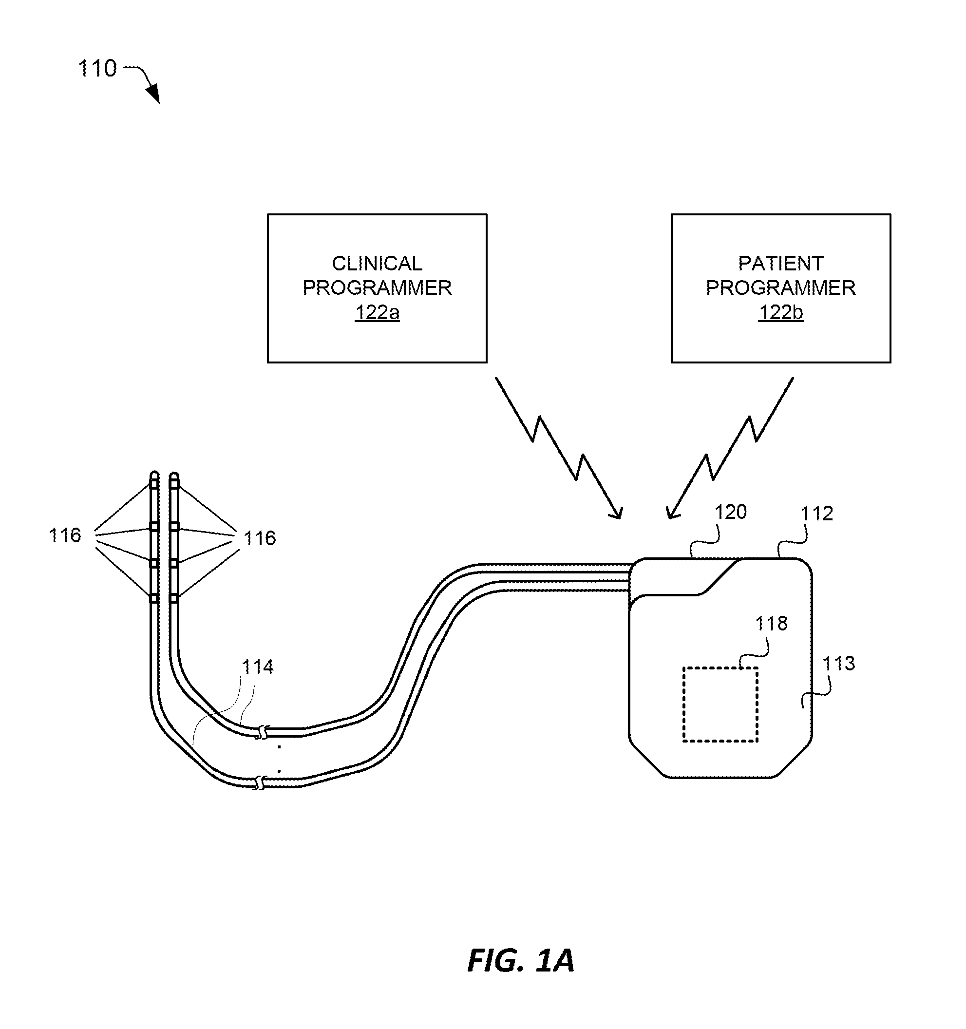 Methods and systems for automatically turning on and off drg stimulation and adjusting drg stimulation parameters