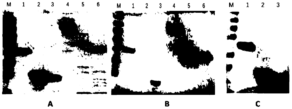 Preparation method and application of E type botulinum toxin recombinant HN-L antigen