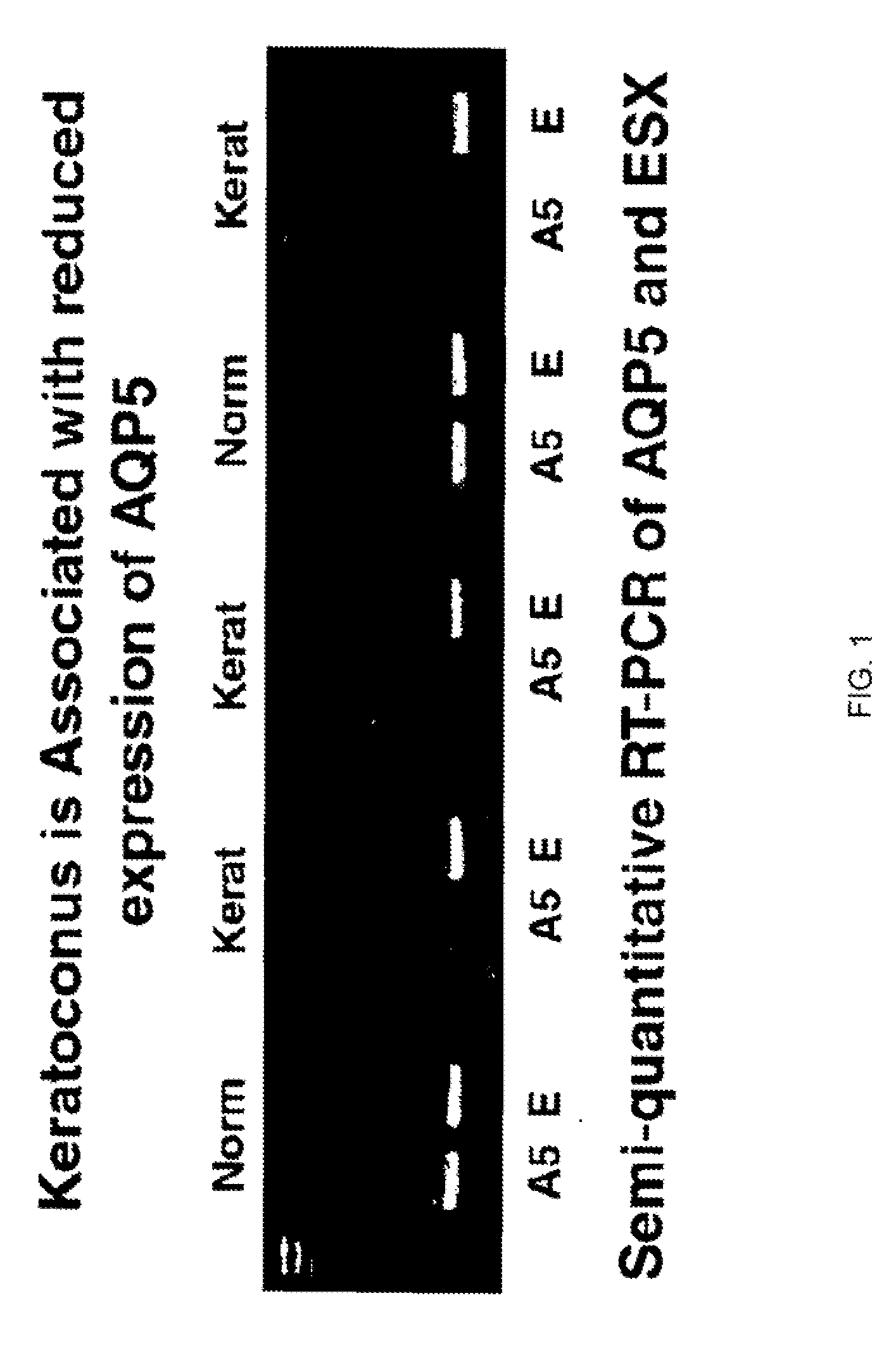 Compositions and methods for detecting keratoconus