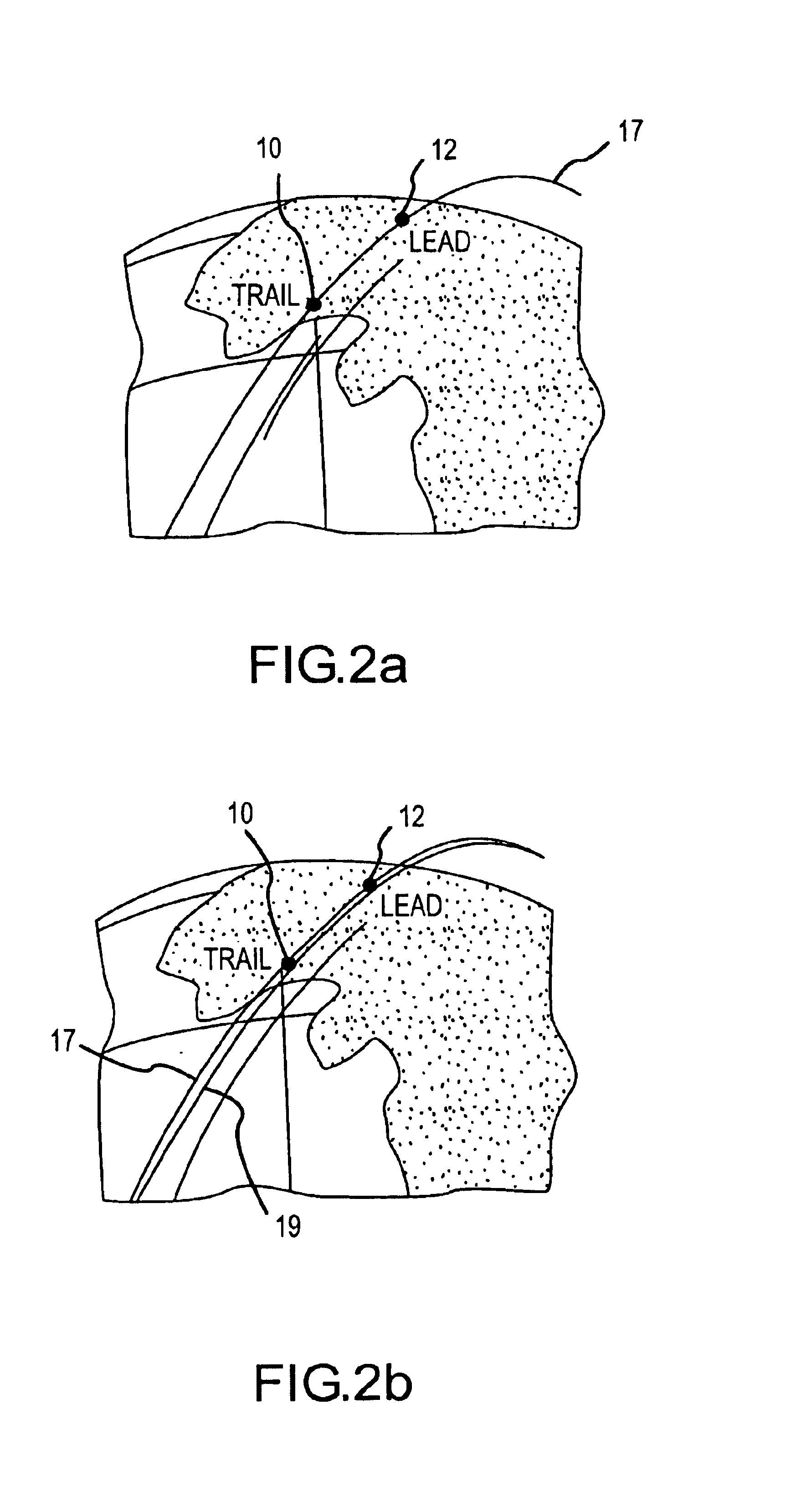 Method and apparatus for collection and processing of interferometric synthetic aperture radar data