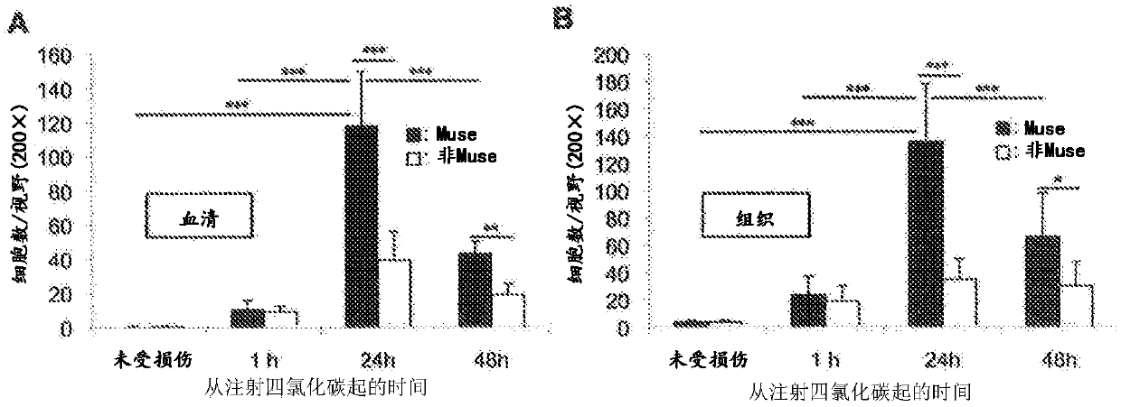 Prophylactic or therapeutic agent for organ fibrosis