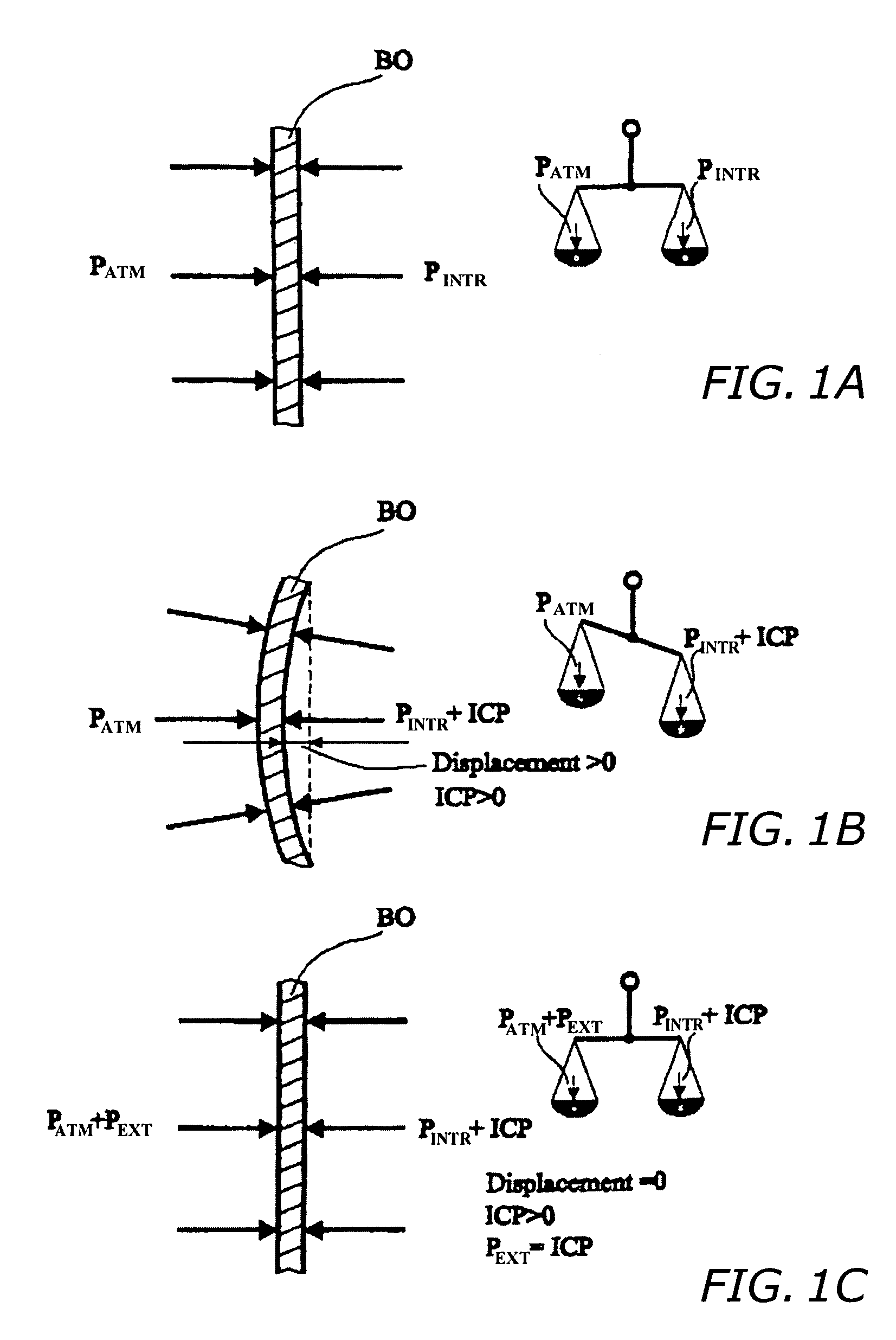 Method and apparatus for noninvasive determination of the absolute value of intracranial pressure