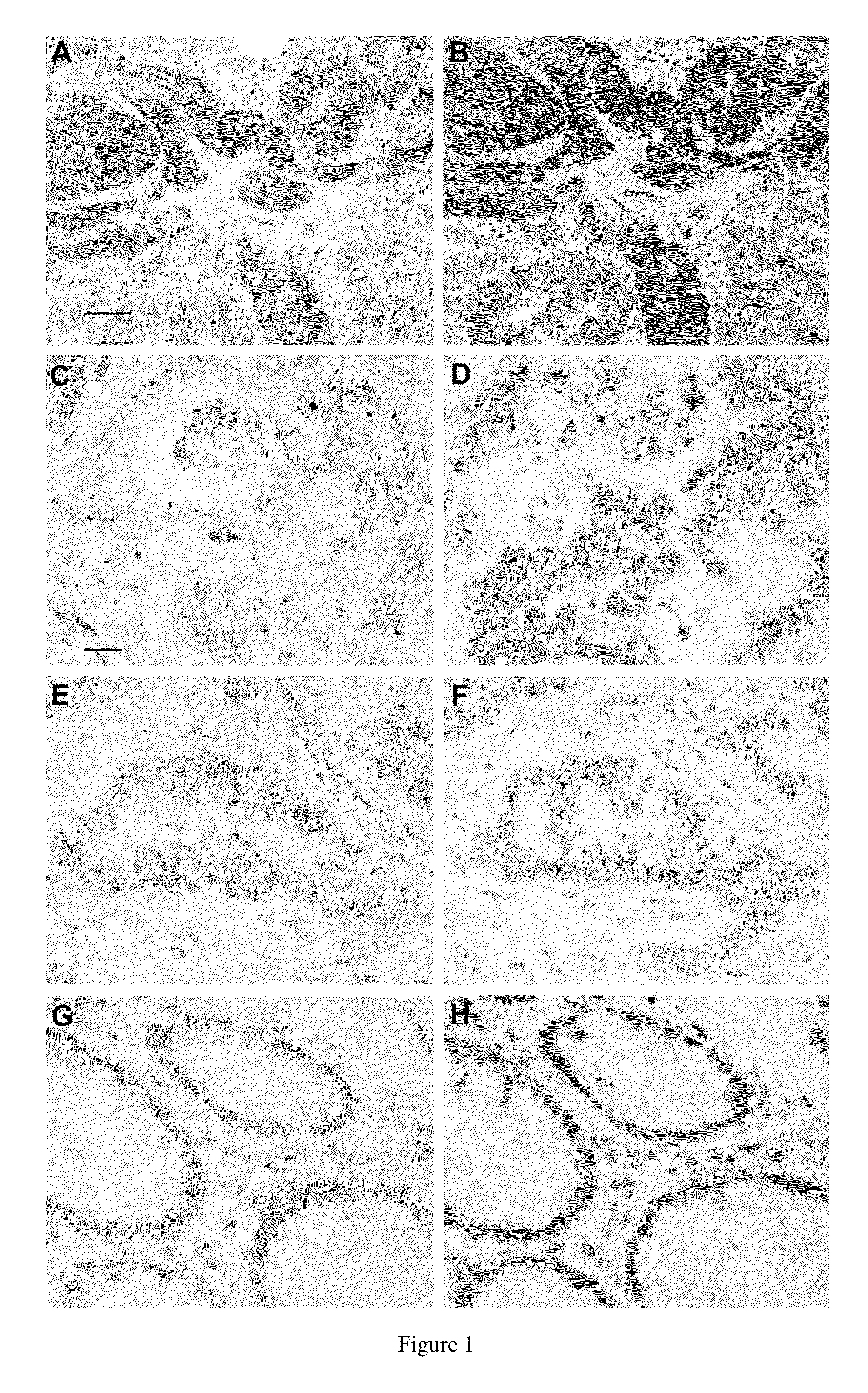 Method for selecting patients for treatment with an EGFR inhibitor