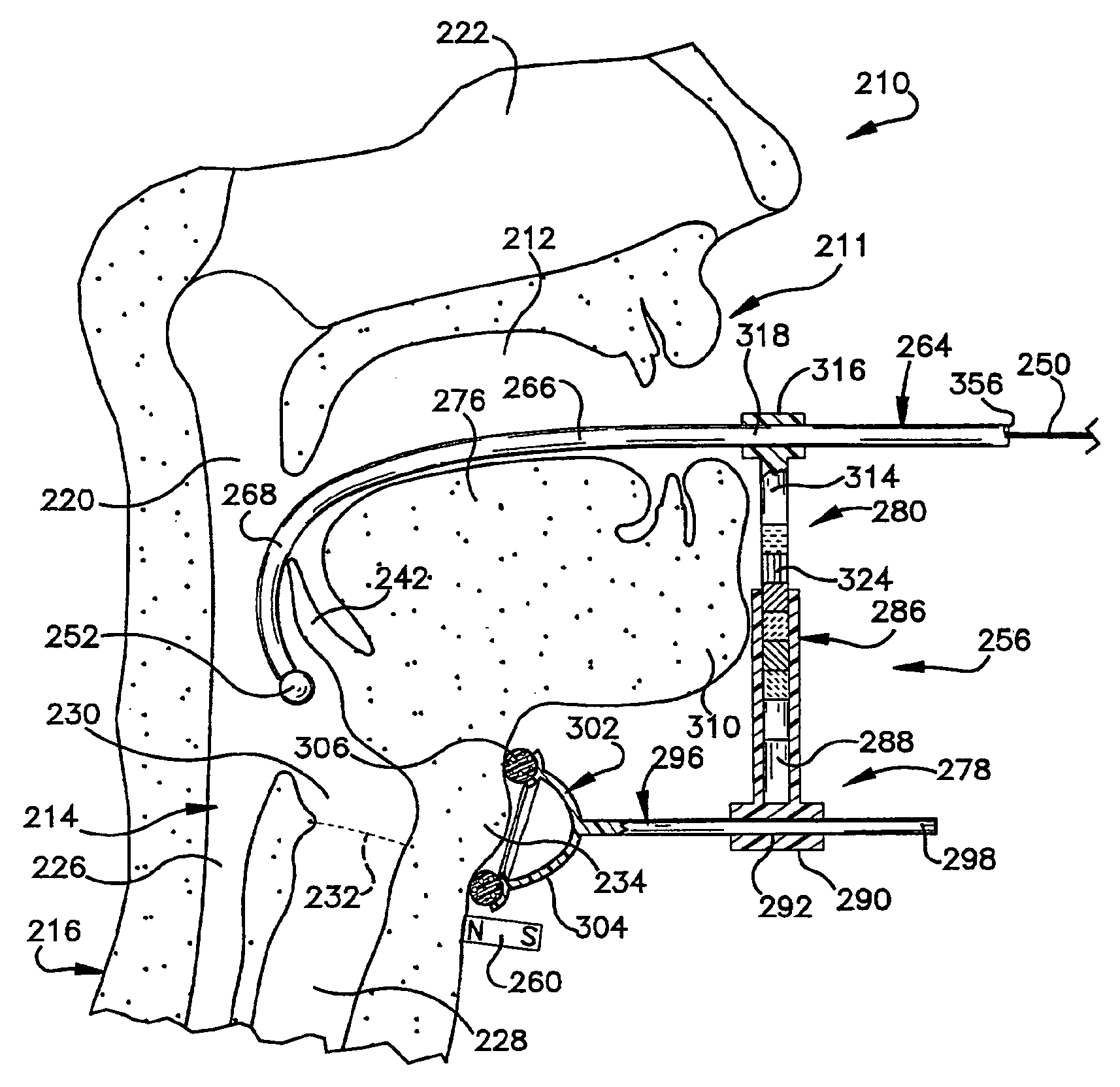 Medical device positioning system and method