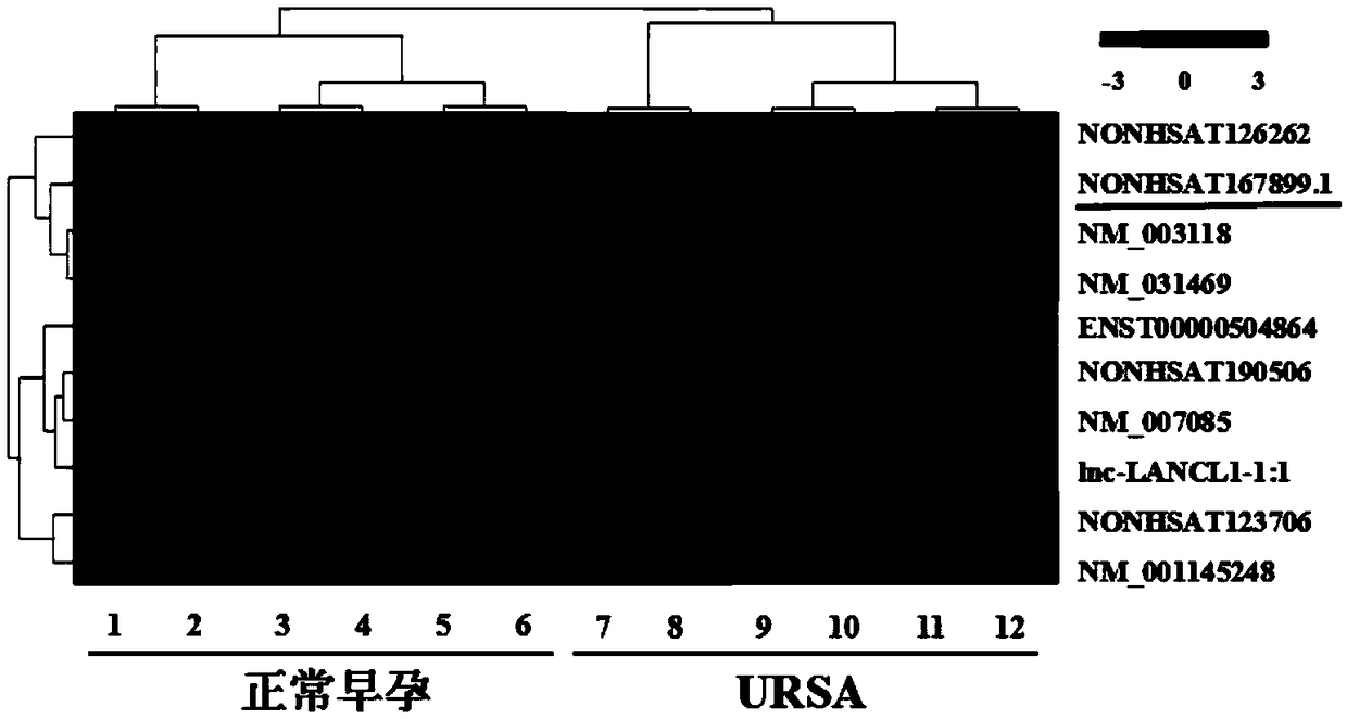 Application of LncRNA in serum as marker to URSA diagnosis and pregnancy outcome evaluation
