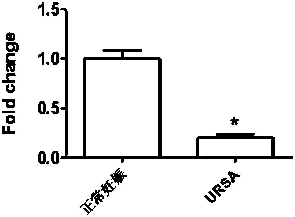 Application of LncRNA in serum as marker to URSA diagnosis and pregnancy outcome evaluation