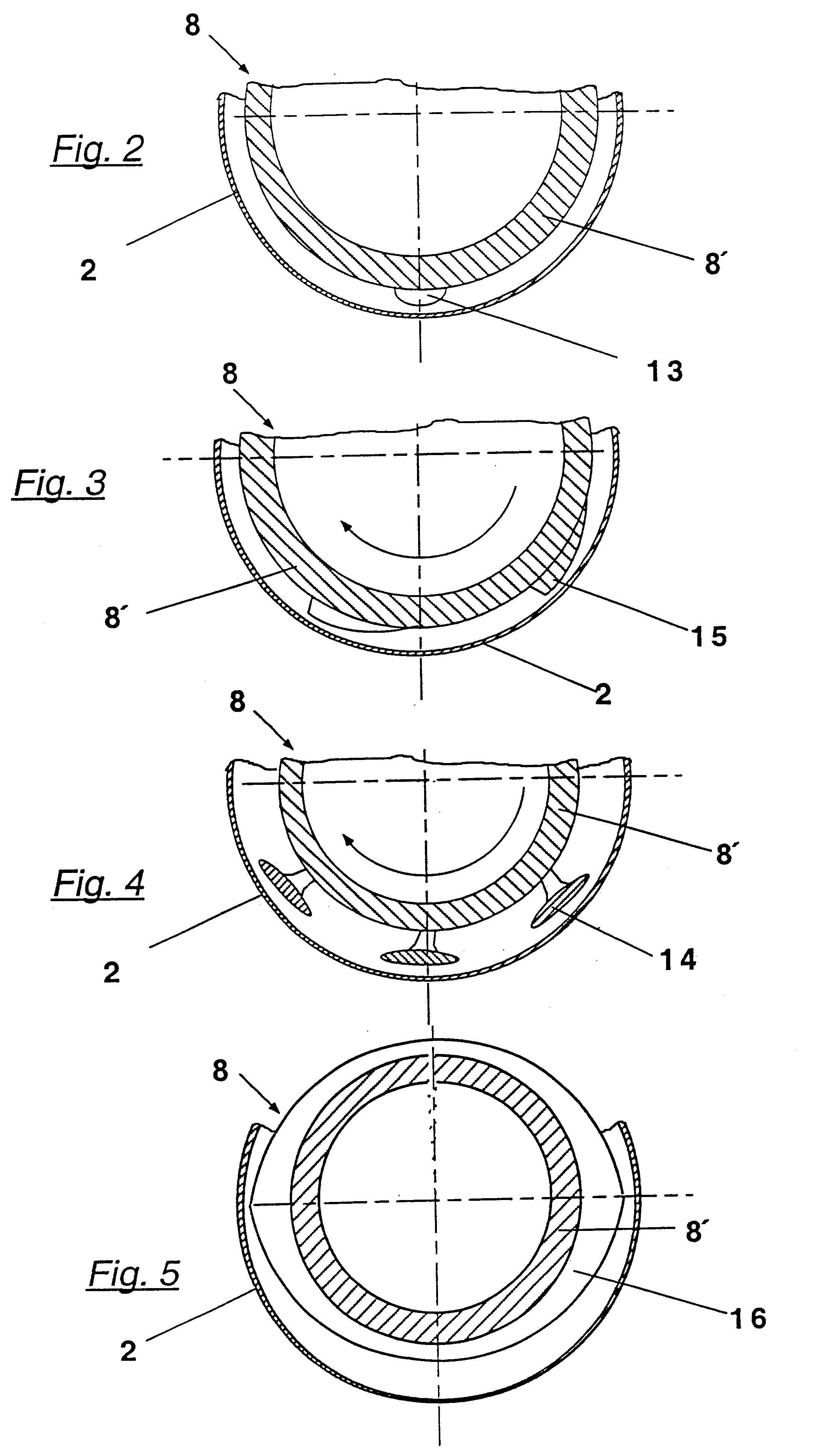 Pressure screening apparatus for screening a paper stock suspension and screen clearer for such a screening apparatus