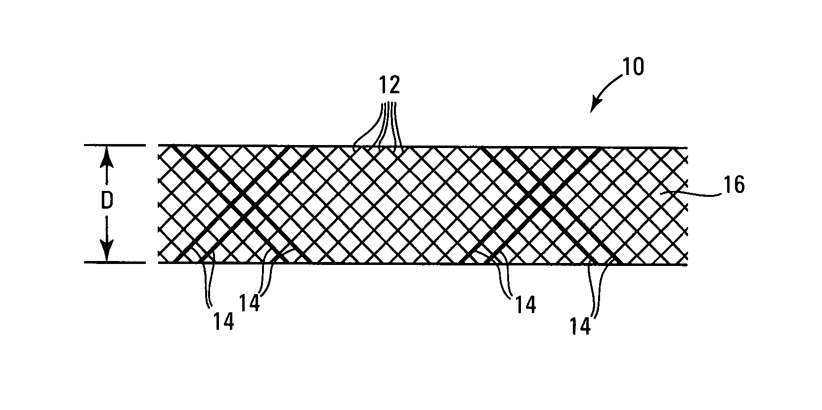 Embolic protection systems having radiopaque filter mesh