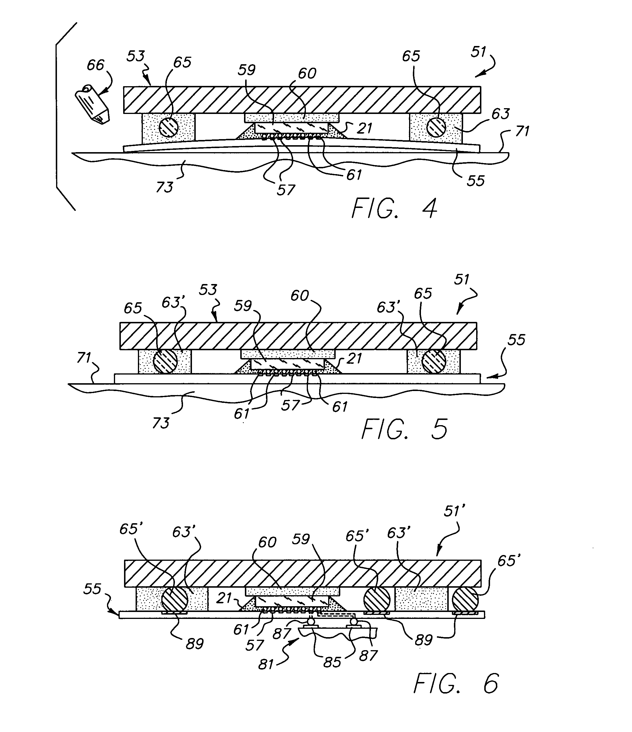 Flexible circuit electronic package with standoffs
