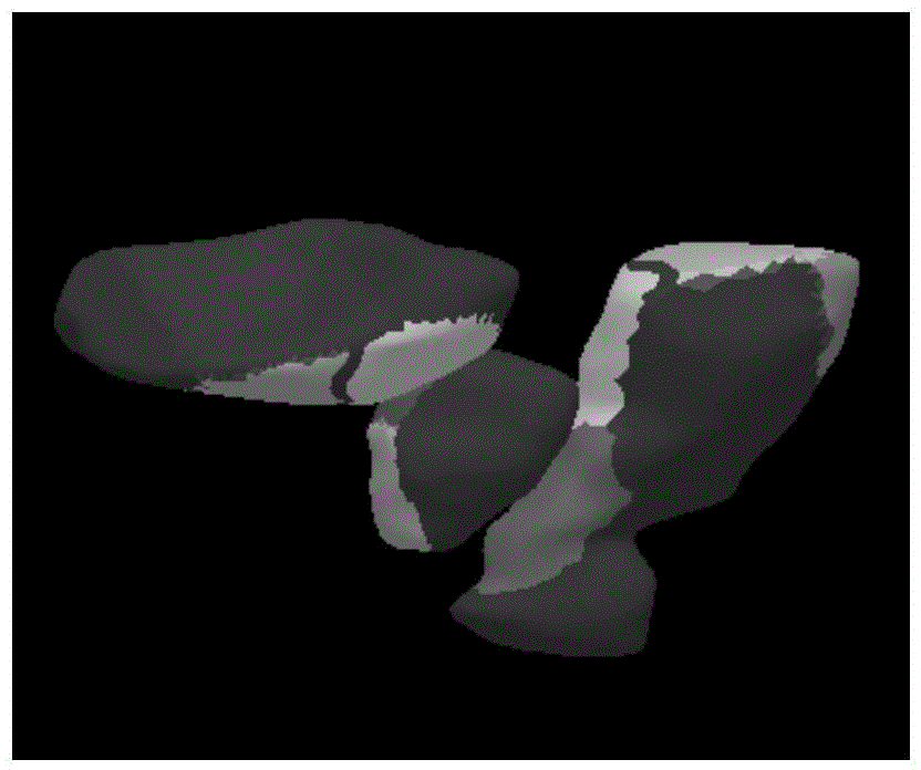 Pelvic organ automatic segmentation method for CT examination