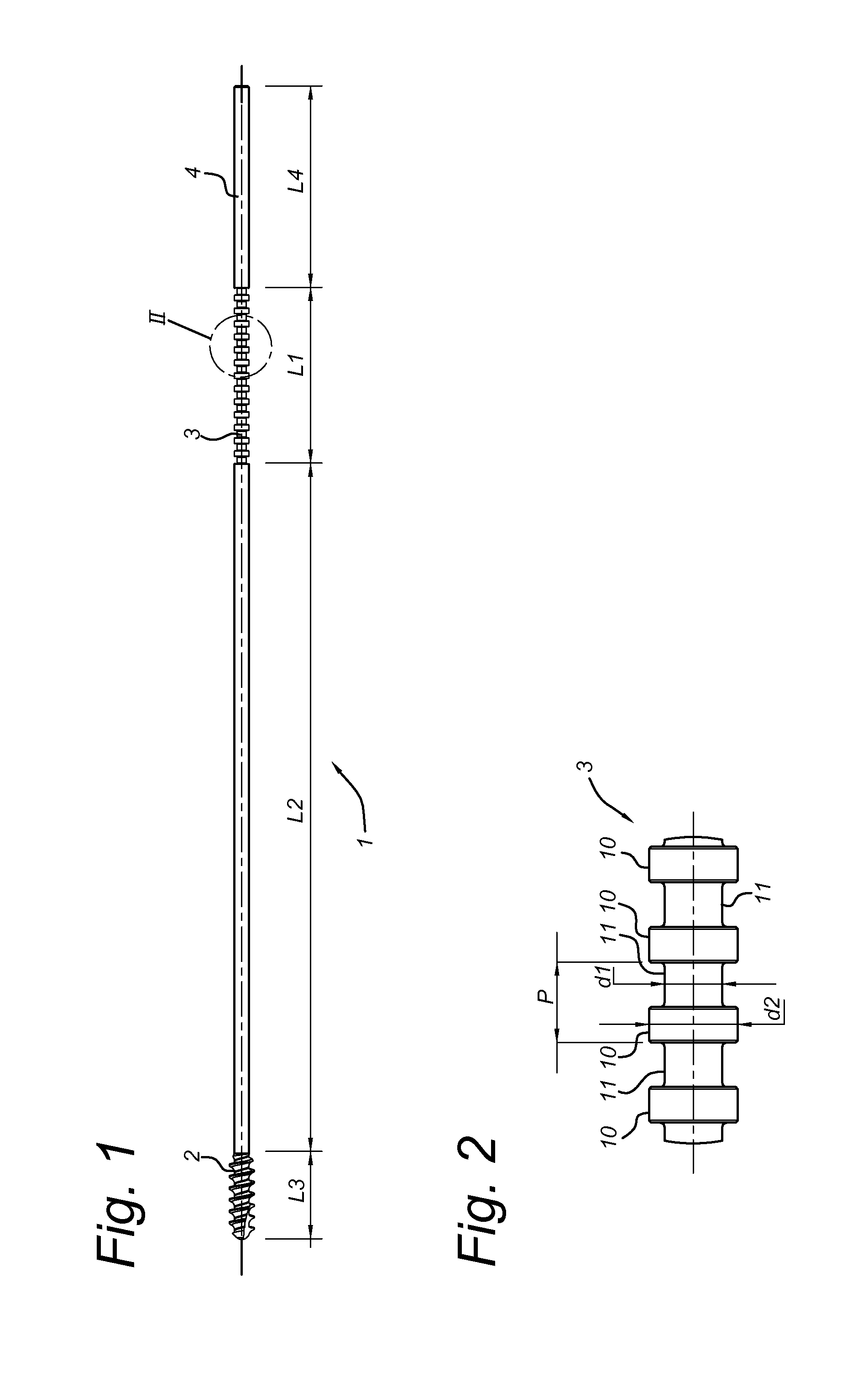 Intramedullary device for mid-shaft clavicle fractures