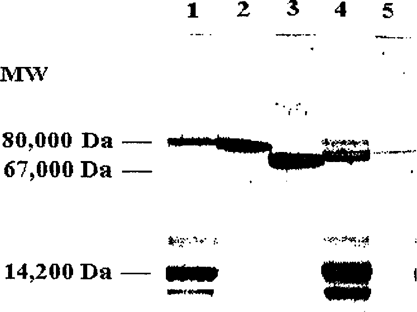 Method of separating lactotransferrin from whey liquid