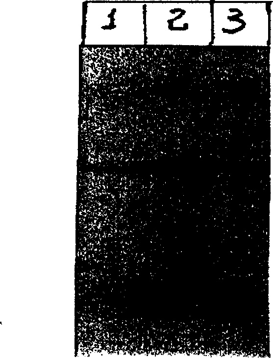 Method of separating lactotransferrin from whey liquid