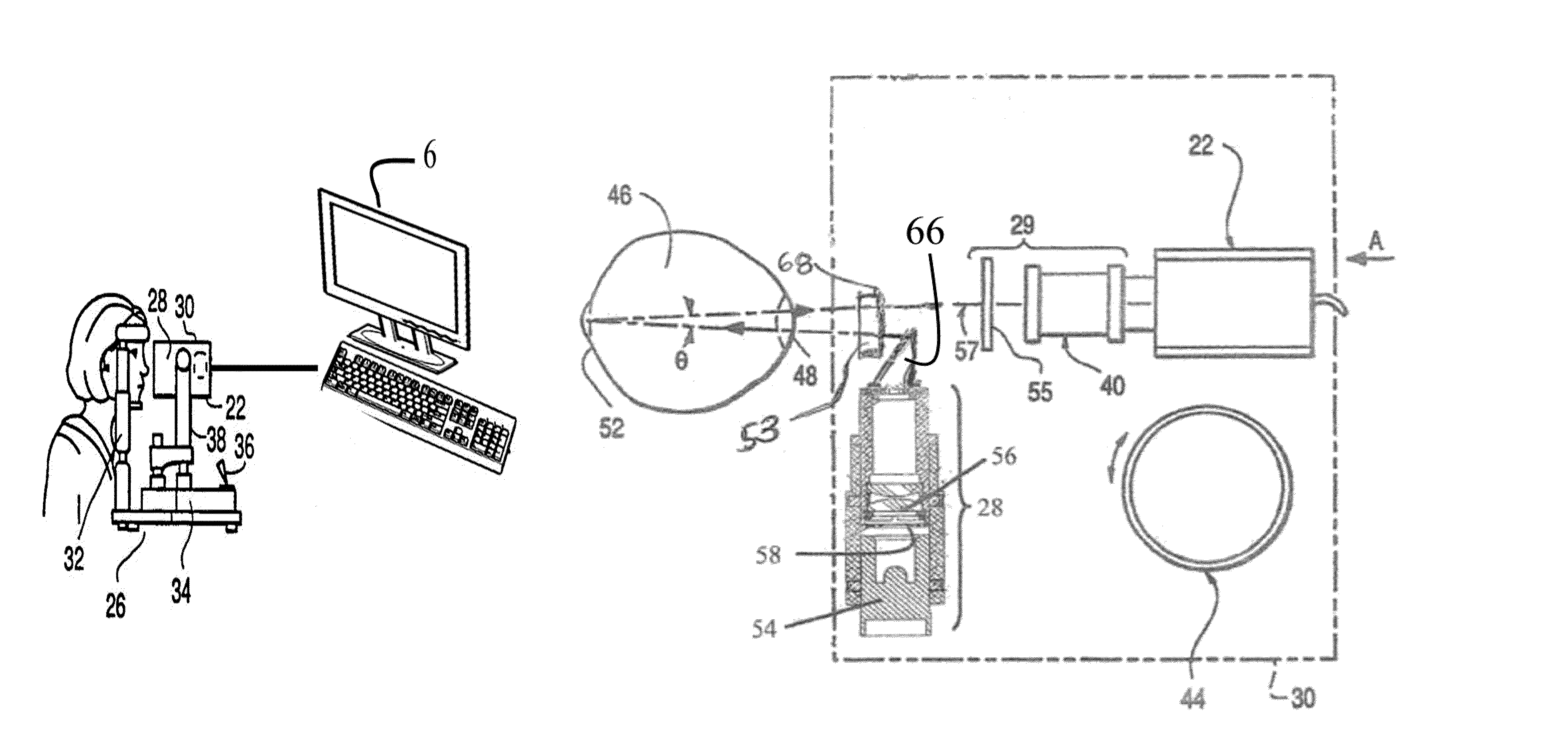 Apparatus and method for imaging the eye