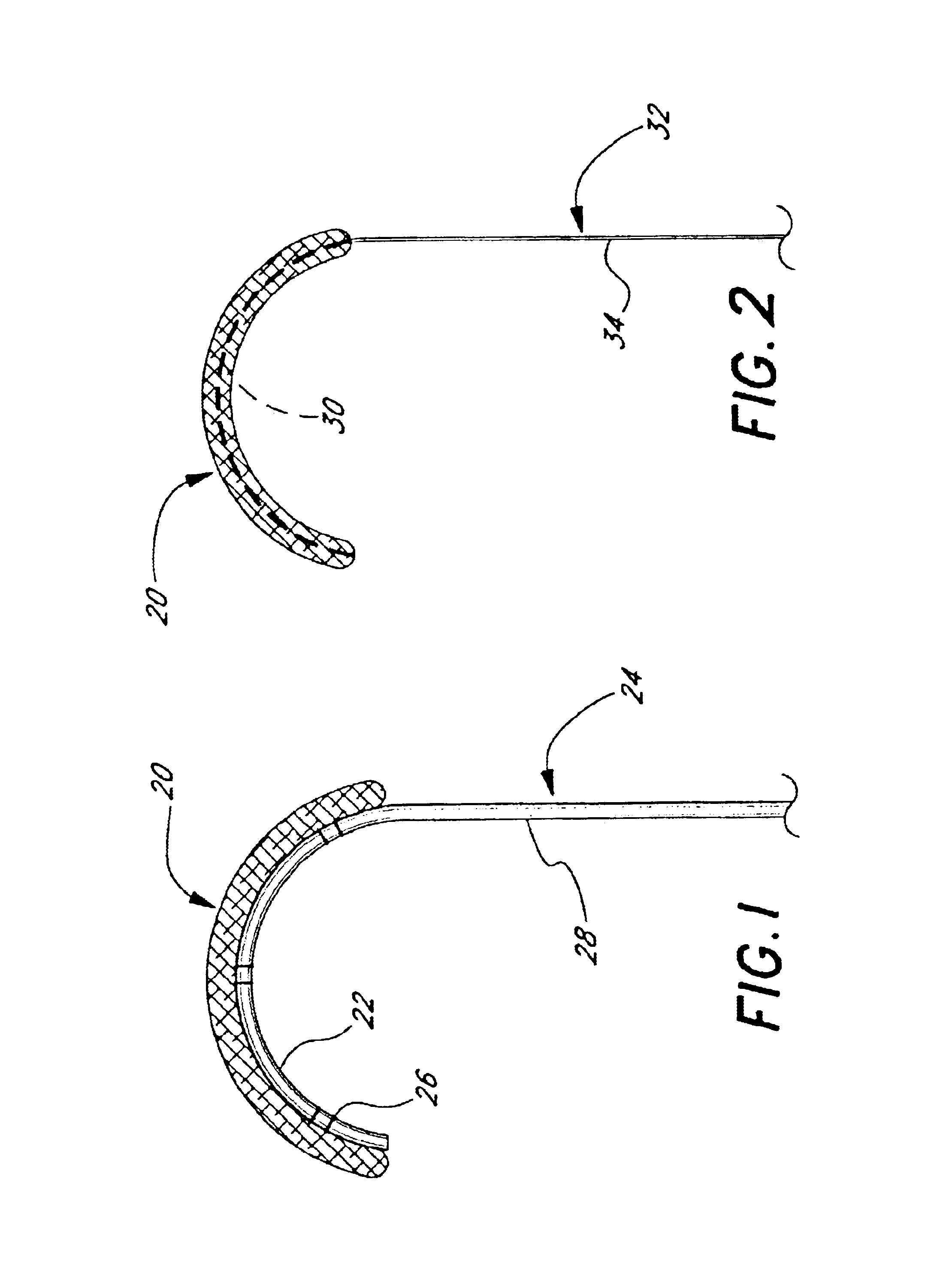 Minimally-invasive annuloplasty repair segment delivery template and system