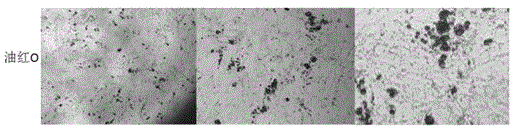 Preparation of efficient and stable trace kit for detecting triglyceride in fat cells