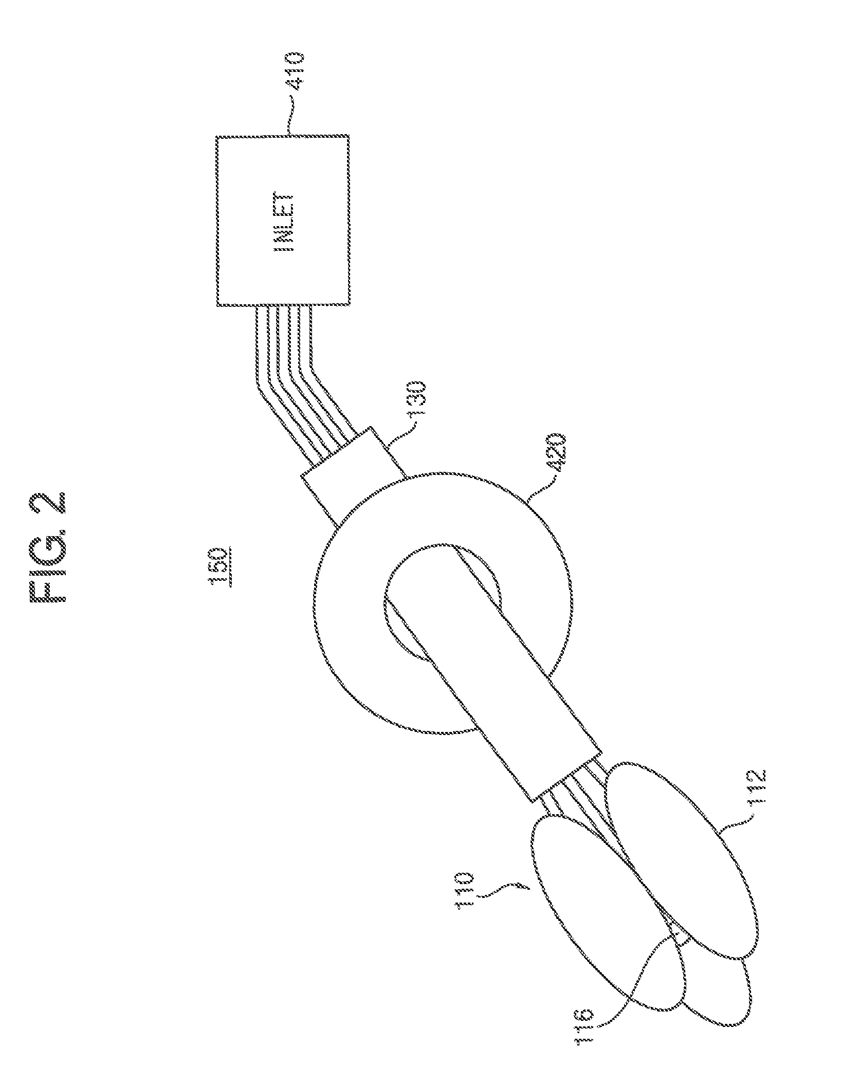 Triple endorectal ballooning system for prostate cancer radiotherapy