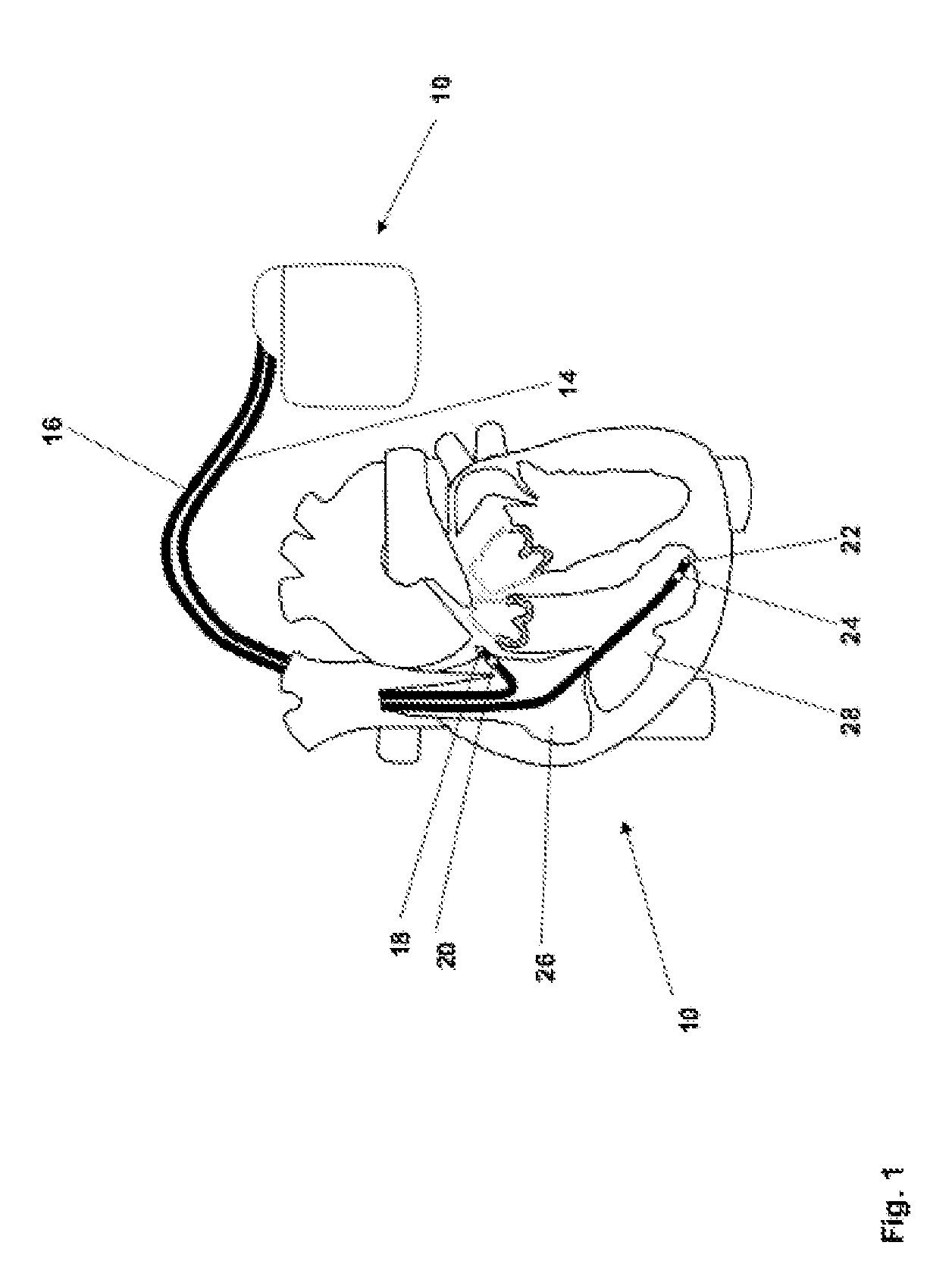 Implantable medical device comprising magnetic field detector