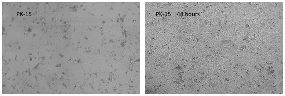 Universal serum-free medium supporting multiple vaccine cell adherent or suspension culture and preparation method thereof