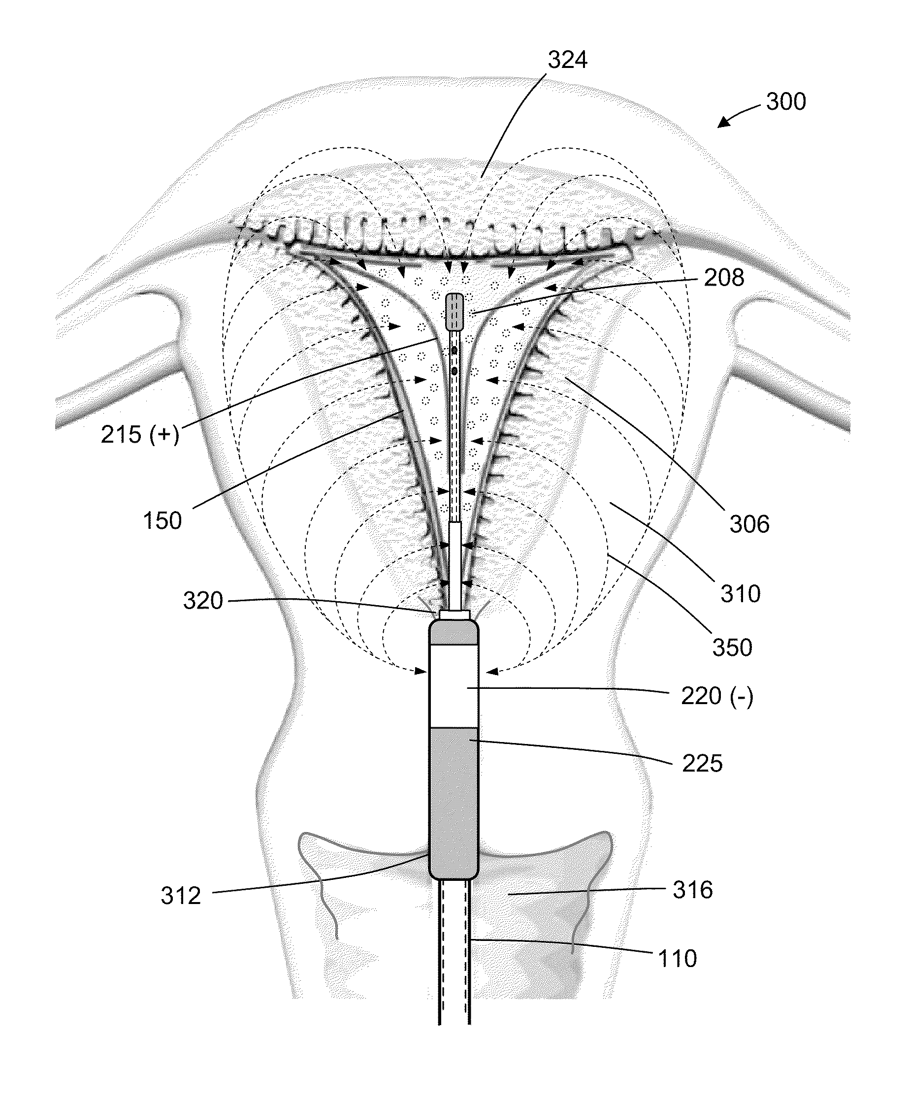 Methods for evaluating the integrity of a uterine cavity