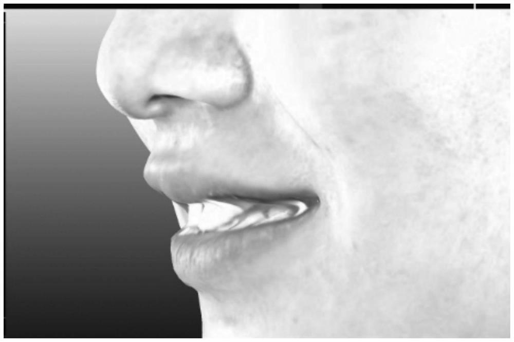 A method to improve the accuracy of facial scan image registration dentition scan image