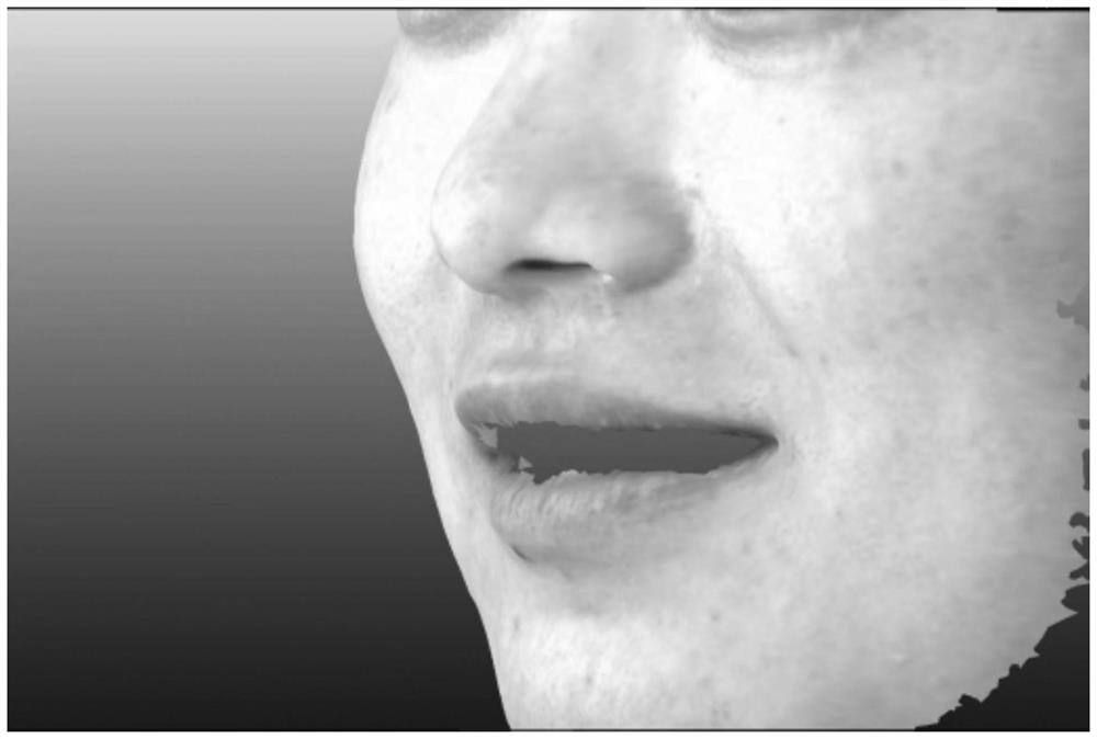 A method to improve the accuracy of facial scan image registration dentition scan image