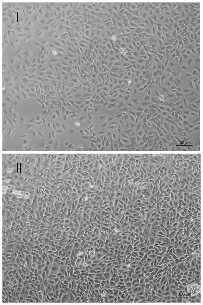 Mouse ovarian granulosa cell separation, culture and in-vitro injury model construction method