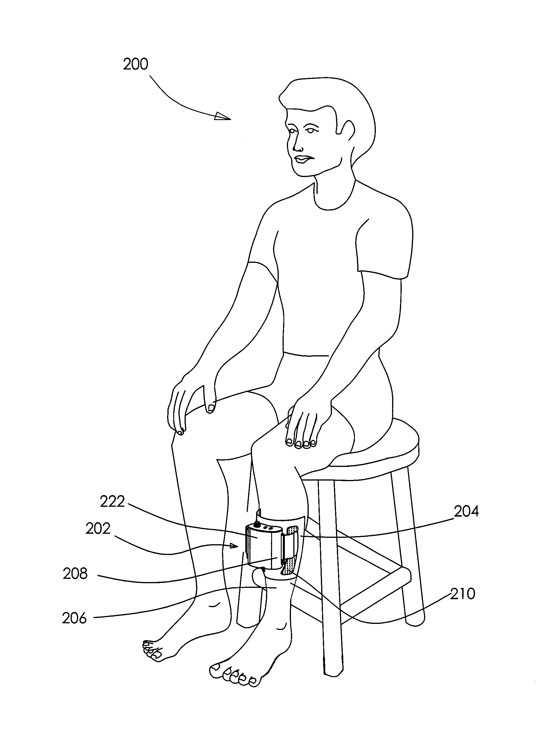 Sleeves for accomodating a circulation enhancement device