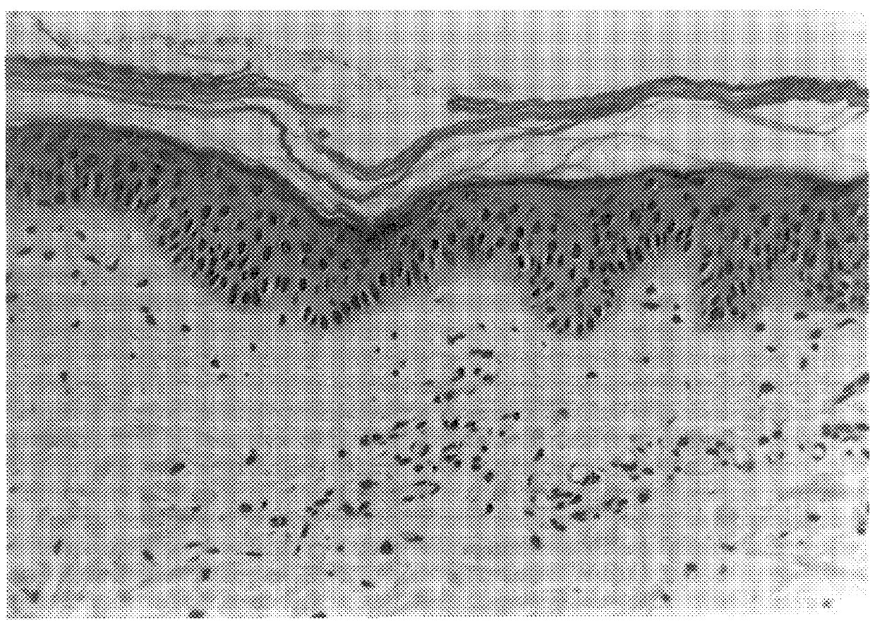 Pellets obtained from cell cultures of keratinocytes and their use in wound healing