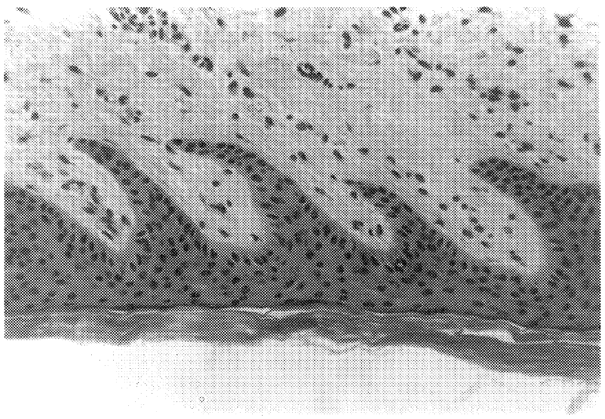 Pellets obtained from cell cultures of keratinocytes and their use in wound healing