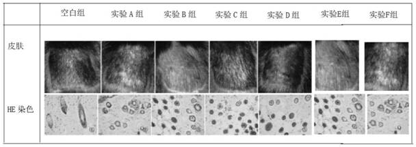 Compound external preparation for preventing and treating alopecia and promoting hair growth