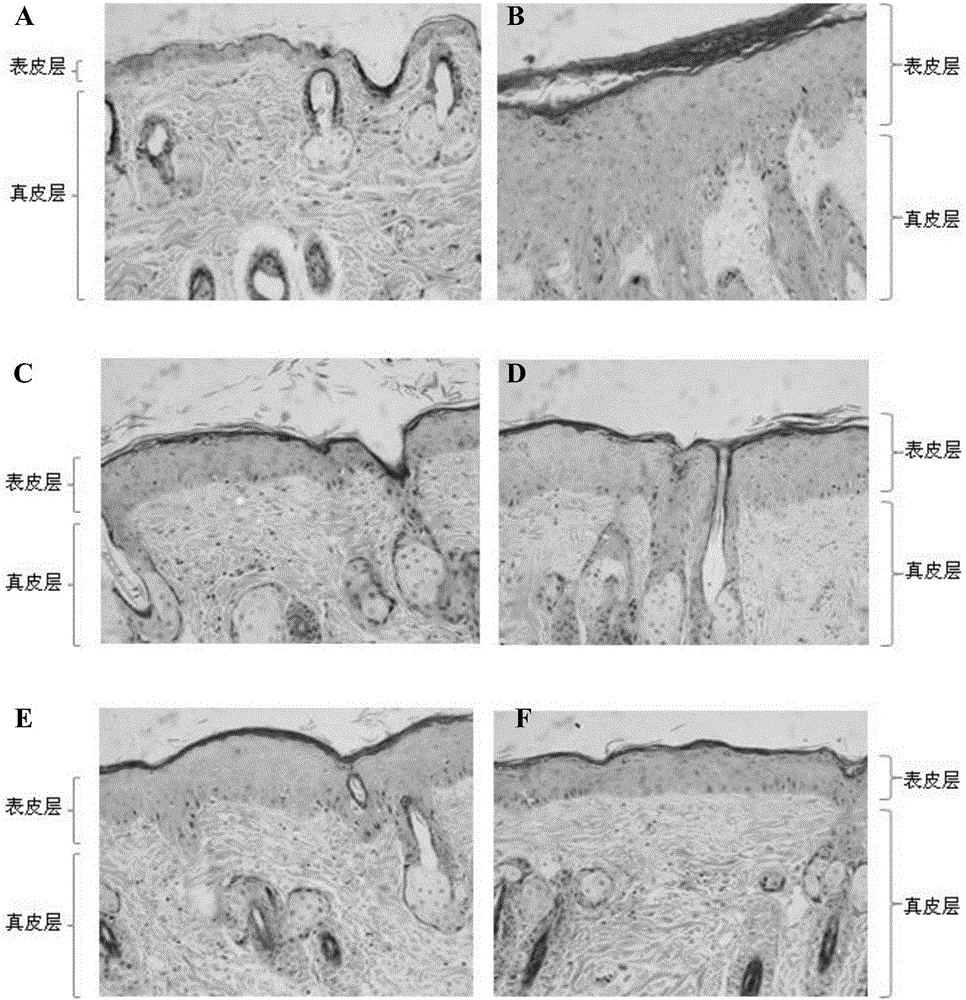 Composition with functions of delaying skin photoaging and/or resisting radiation and application thereof