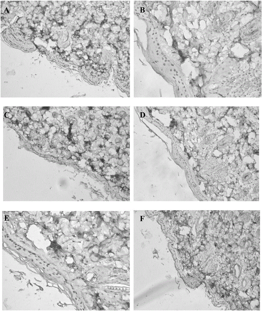 Composition with functions of delaying skin photoaging and/or resisting radiation and application thereof