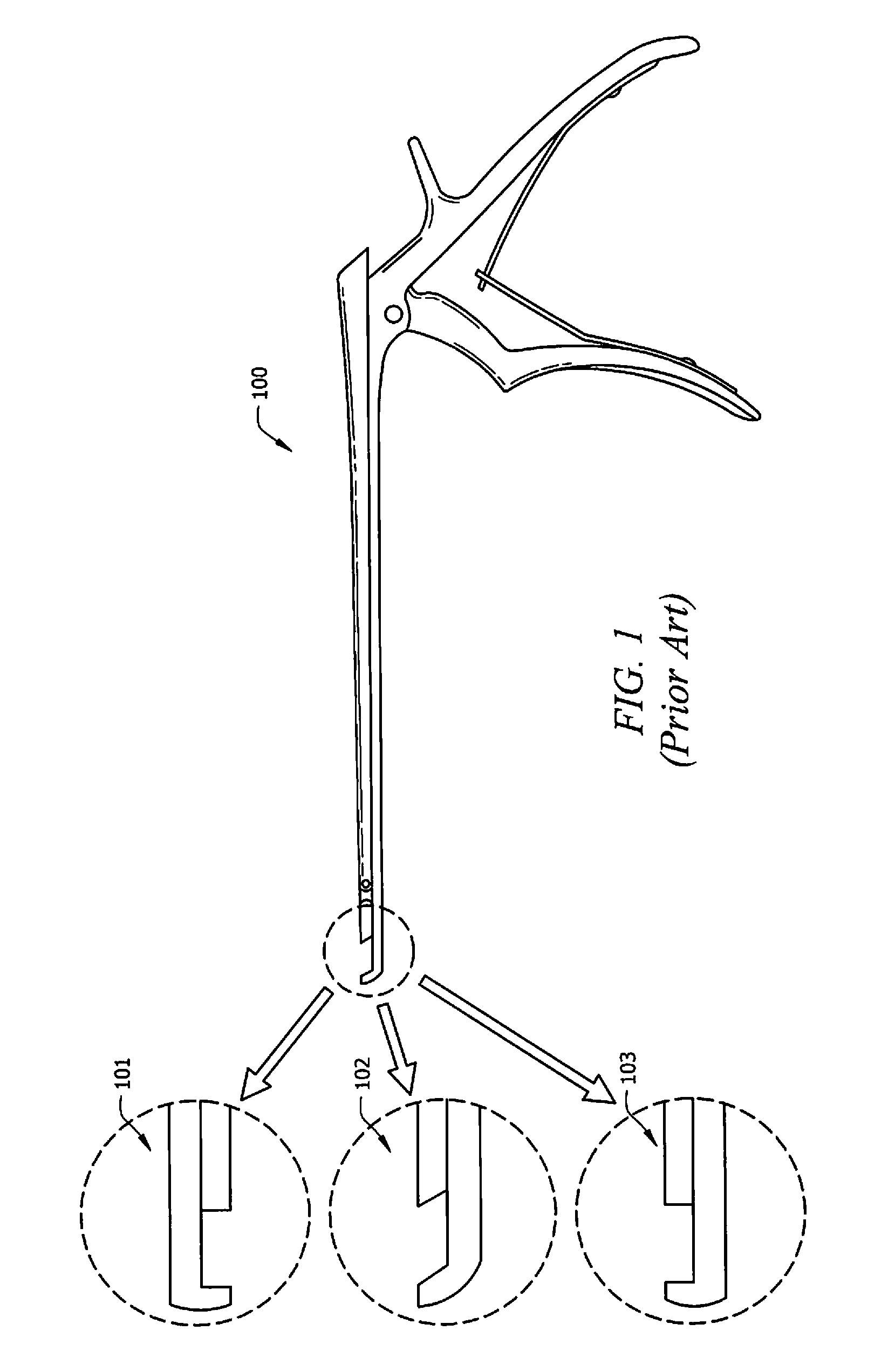 Methods and Devices for Implementing an Improved Rongeur