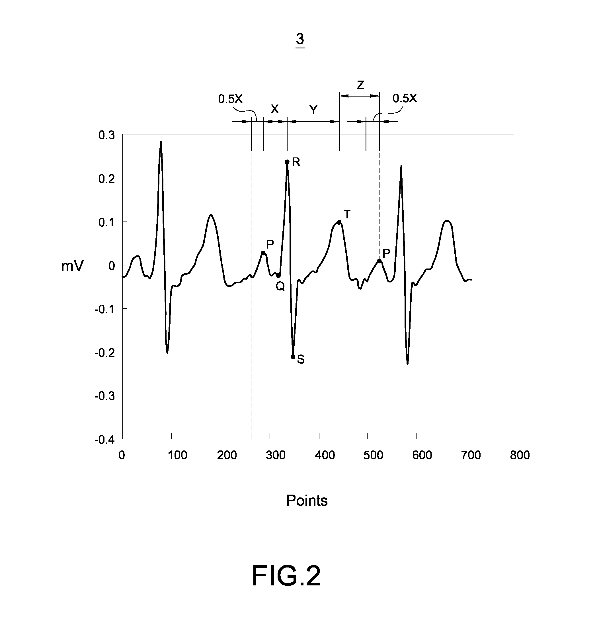 Calibration method of electrocardiogram signals and the application program for the same