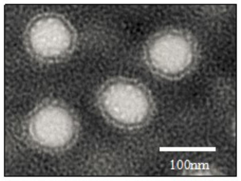 ROS response type nano-carrier based on microglial cell phenotype regulation and intracerebral iron removal as well as preparation method and application of ROS response type nano-carrier